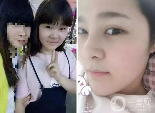 整容對人生的改變真的大嗎 整容后的人生變好了嗎