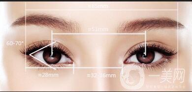 三點定位雙眼皮,全切,埋線