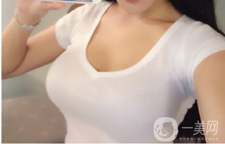 假體豐胸用的什么材料比較好