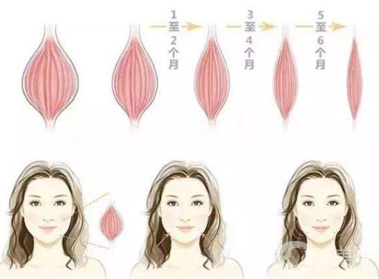 *能維持多長時(shí)間 注射*注意事項(xiàng)