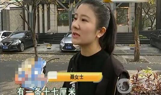 驚！女子花5萬整形，大腿留下17厘米疤痕