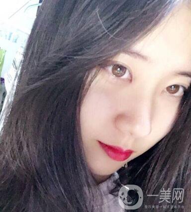 整容到底為了什么？知乎回答扎進(jìn)心窩