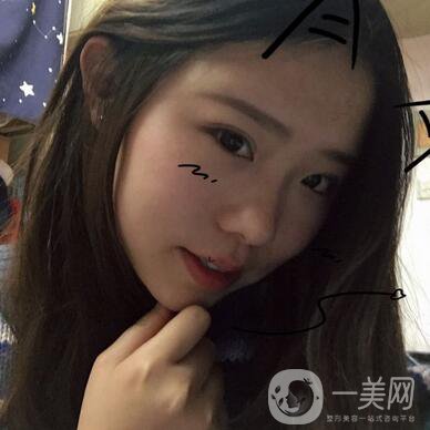 整容到底為了什么？知乎回答扎進(jìn)心窩