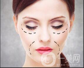 拉皮手術除皺*果,拉皮手術除皺術后護理