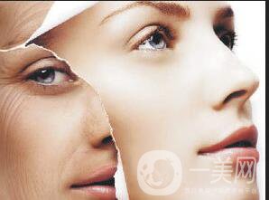 拉皮手術(shù)多久恢復(fù),拉皮手術(shù)注意事項