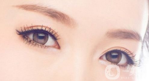 雙眼皮術后如何防止增生 雙眼皮術后護理