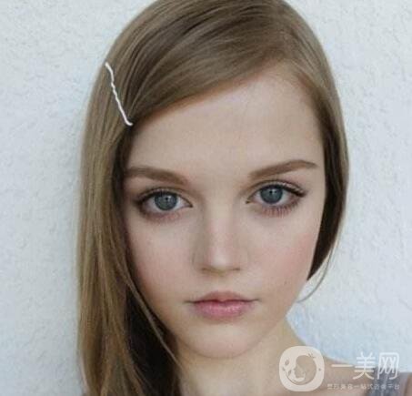 什么是芭比眼平行雙眼皮？