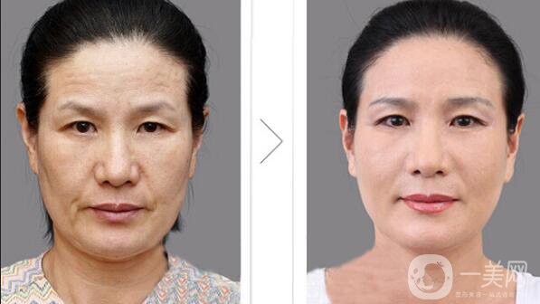 熱瑪吉,超生刀,熱瑪吉和超生刀的區(qū)別