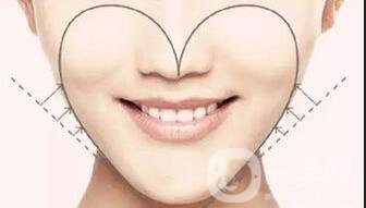 自體脂肪面部填充*果