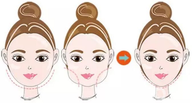 磨顴骨前后圖 磨顴骨多少錢