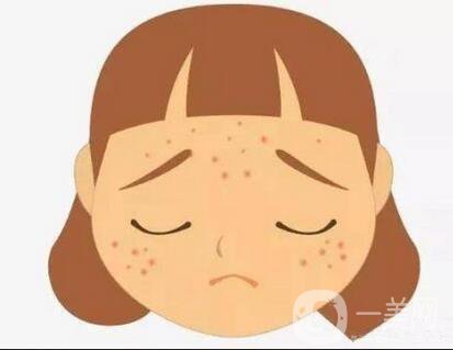 成都激光去痘坑要多少錢 *果好嗎