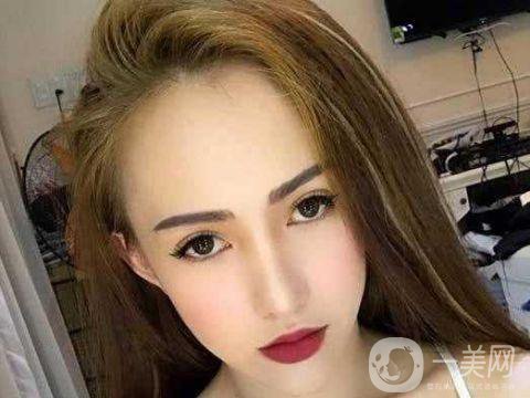 女子被前男友嫌丑 怒花12萬(wàn)整容成美女