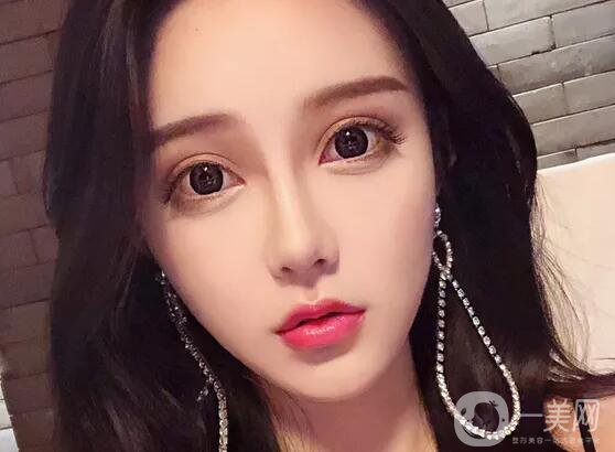 注射隆鼻好嗎 有哪些缺點(diǎn)呢？