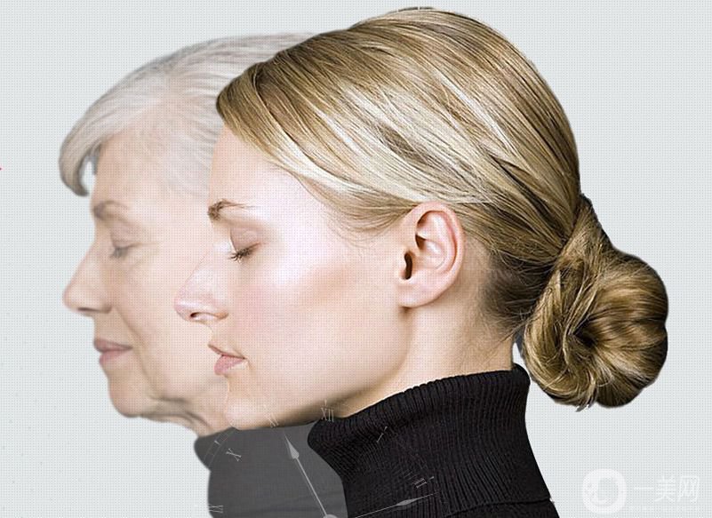 熱瑪吉除皺價格是多少錢 熱瑪吉*果怎么樣