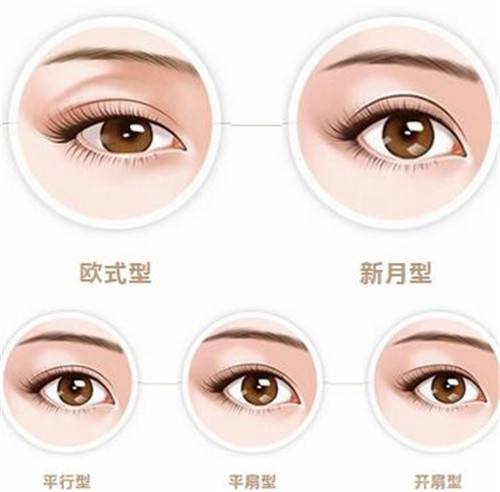 冬季割雙眼皮注意什么？術(shù)后吃什么好？