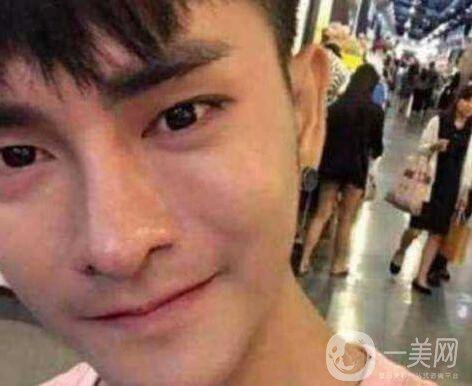 小伙整容數(shù)十次，只為一張韓星臉