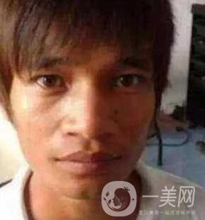 小伙整容數(shù)十次，只為一張韓星臉