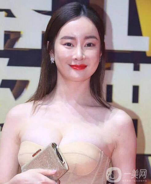 賈靜雯、迪麗熱巴的雙眼皮是不是割的 看了這個(gè)你就明白了