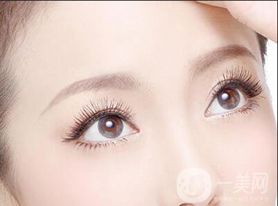 韓式*開眼角價格