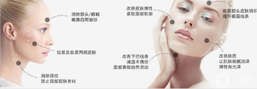 熱瑪吉除皺價(jià)格 熱瑪吉除皺*果好嗎