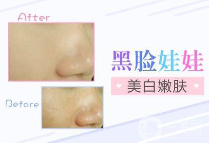 黑臉娃娃*果,黑臉娃娃優(yōu)勢(shì)