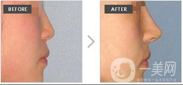 南京王志軍醫(yī)療美容診所價格表2019提前曝光