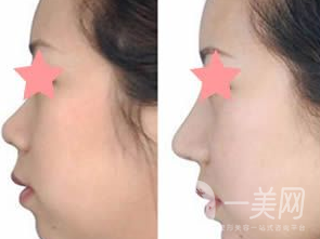 福建省莆田市城廂區(qū)文獻(xiàn)西路553號