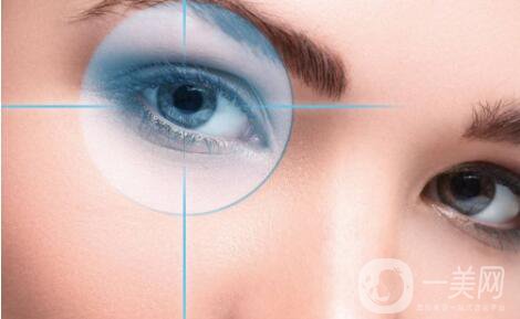 開眼角手術(shù)前后 開眼角手術(shù)后注意事項(xiàng)