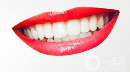 什么是牙齒種植？牙齒種植如何做？