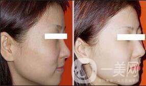 黑臉娃娃注意事項(xiàng)