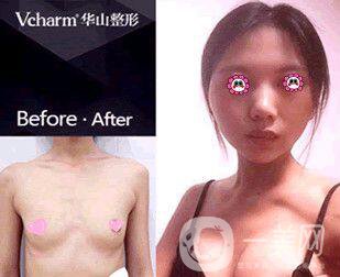 鄭州*整形醫(yī)院