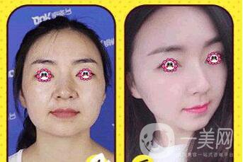 鄭州*整形醫(yī)院