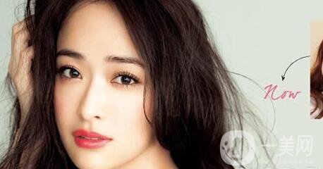 墊鼻梁,墊鼻梁術(shù)后注意什么,隆鼻術(shù)后護理