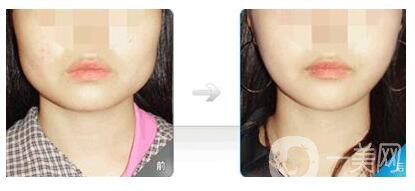 廣州南方醫(yī)科大學(xué)珠江醫(yī)院整形美容外科