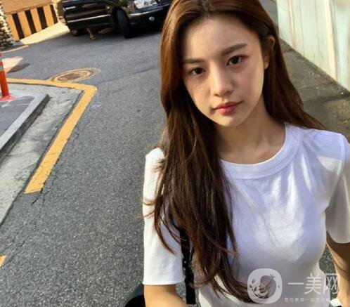 做完整容手術(shù)后你能有多開心？