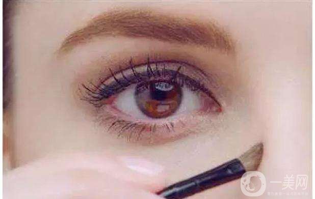 上海假體豐眉弓價格 豐眉弓材料有哪些