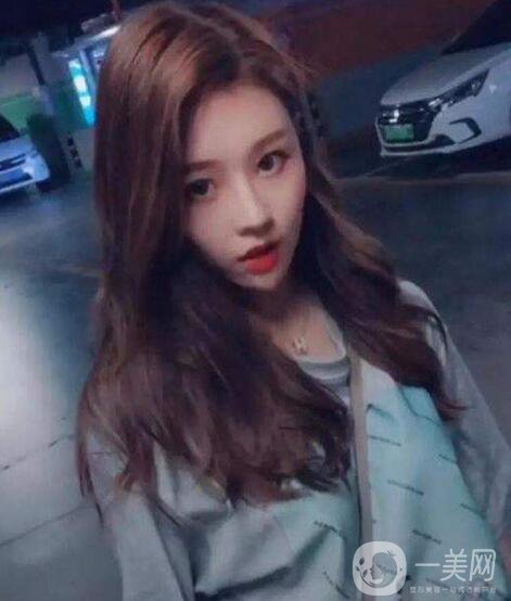 整容為什么越來越火？ 溫婉