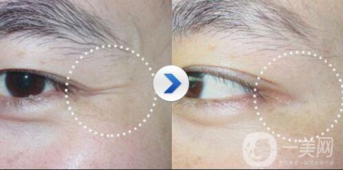 金瀚回應(yīng)丑帥男星，沒有整容的朱一龍也上榜了