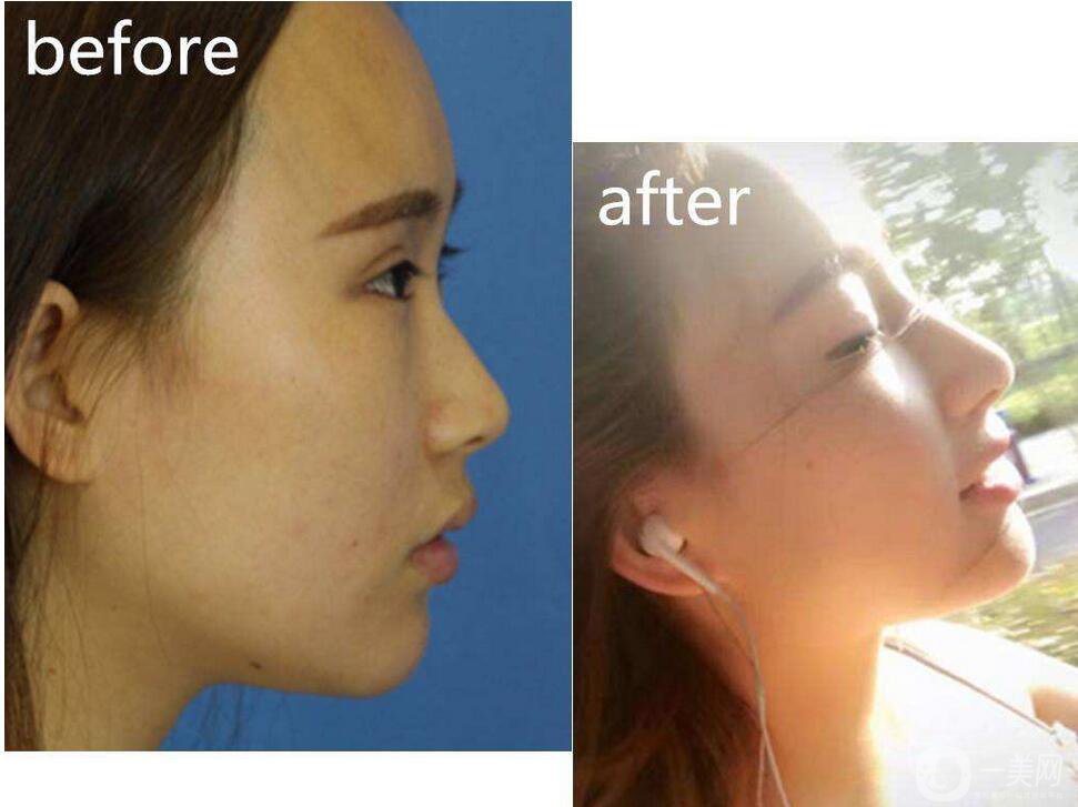 金瀚回應(yīng)丑帥男星，沒有整容的朱一龍也上榜了