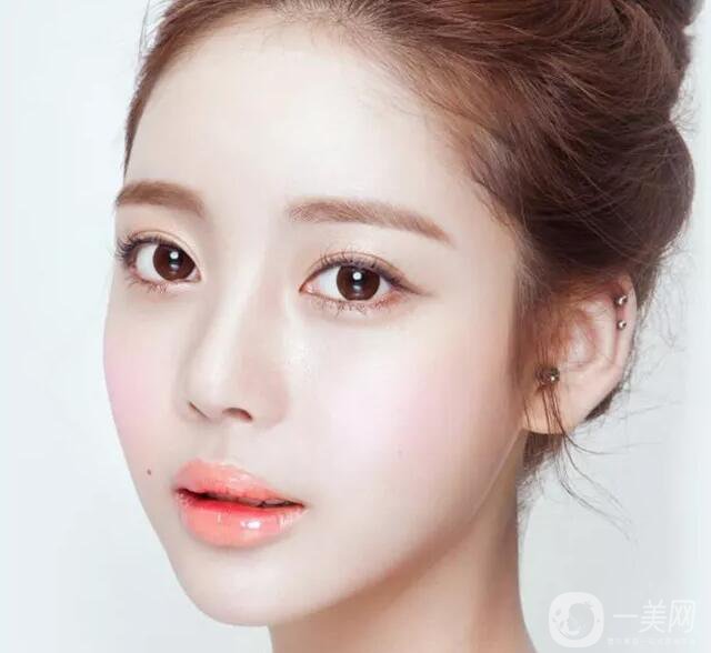 韓式開眼角手術(shù)*果怎么樣？