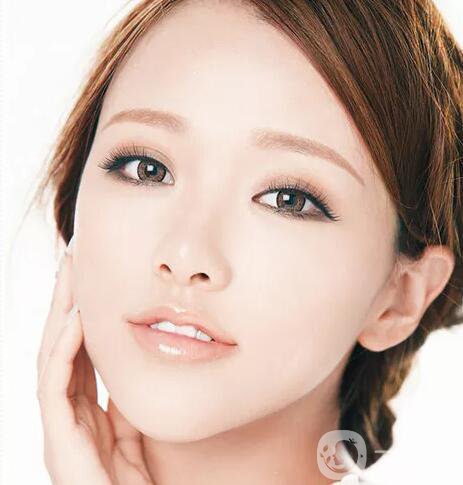 韓式開眼角手術(shù)*果怎么樣？