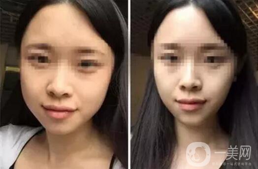 **果好嗎？*前后圖