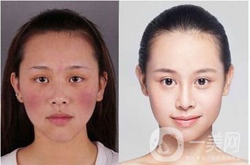 臉上很多紅血絲怎么辦？給你1個(gè)小法寶和紅血絲說(shuō)再見(jiàn)