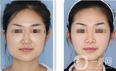 *的價格 *的作用有哪些