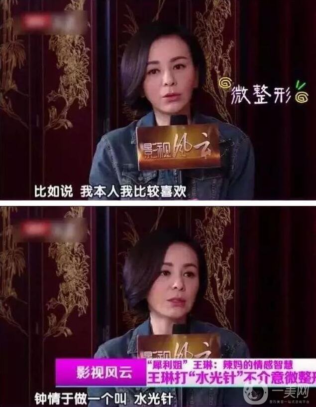 為什么眾多明星都鐘愛*？