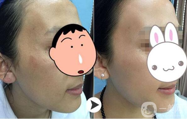 為什么眾多明星都鐘愛*？