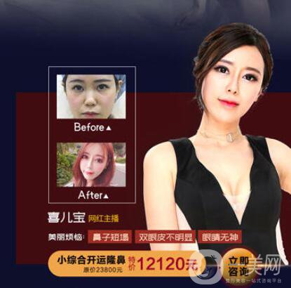 佛山夢露整形醫(yī)院跨年狂歡月 積贊當(dāng)錢花