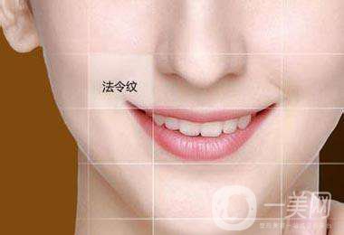 玻尿酸去法令紋手術價格 *果好不好