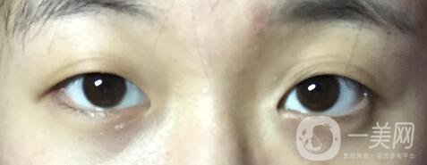 整容整得好看是怎樣一種體驗(yàn)？眾知乎美女回答讓你羨慕嫉妒恨！