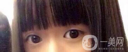 整容整得好看是怎樣一種體驗(yàn)？眾知乎美女回答讓你羨慕嫉妒恨！